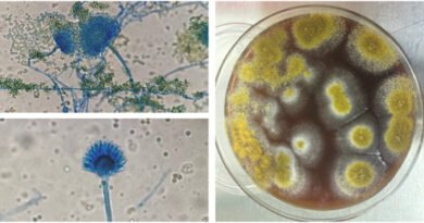 Una batalla delicada: Una infección fúngica rara en un neonato extremadamente prematuro