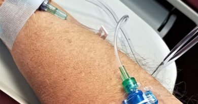 Un estudio retrospectivo muestra que la inmunoquimioterapia temprana mejora los resultados en el cáncer de pulmón de células pequeñas en estadio extendido