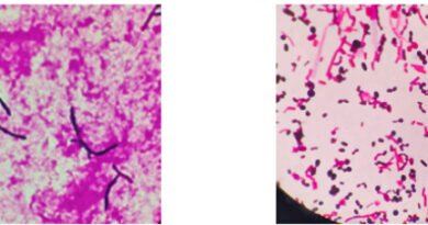 Irish Scientists Report First Known Case of Dual Trichosporon inkin Infection After Lung Transplant
