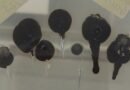 First Known Case of a Rare Fungus Causing Nail Infection Reported in Colombia