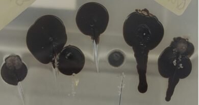 First Known Case of a Rare Fungus Causing Nail Infection Reported in Colombia